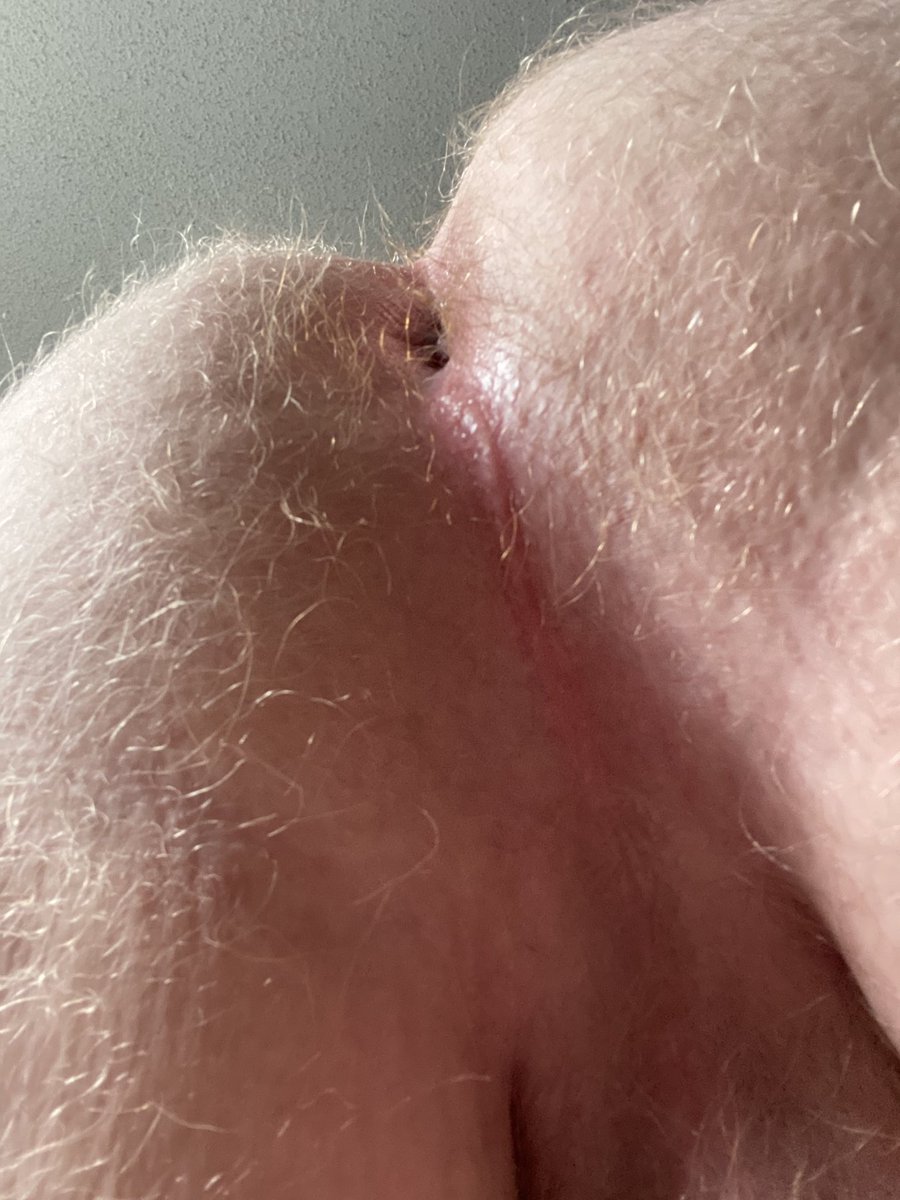 GingerBeef tweet media