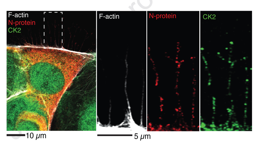 ...and while the phosopho-proteome is cool, the most interesting part for us came from images obtained by  @grosse_lab showing that SARS-CoV2 induces formation of crazy, branched filopodia. [2/3]