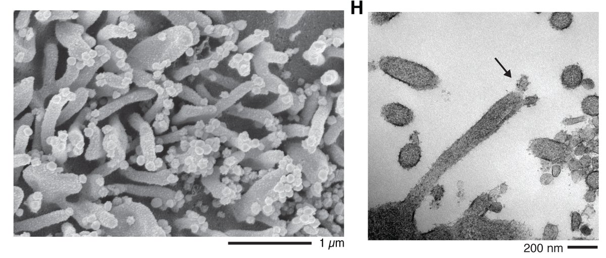 ...while EM's from the NIH/NIAID/Rocky Mountain Laboratories in Montana (which has electron microscopes in a BSL4 facility) show that the viruses bud primarily off of these filopodia. [3/3]  @grosse_lab