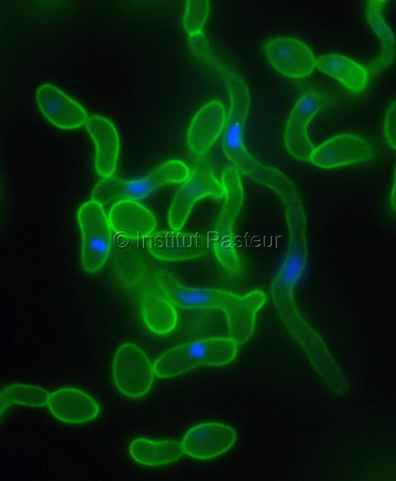 MicrobesInfect's tweet image. Studying fungal pathogens of humans and fungal infections:

Fungal diversity and diversity of approaches

sciencedirect.com/science/articl… #Cryptococcus #Aspergillus #Candida