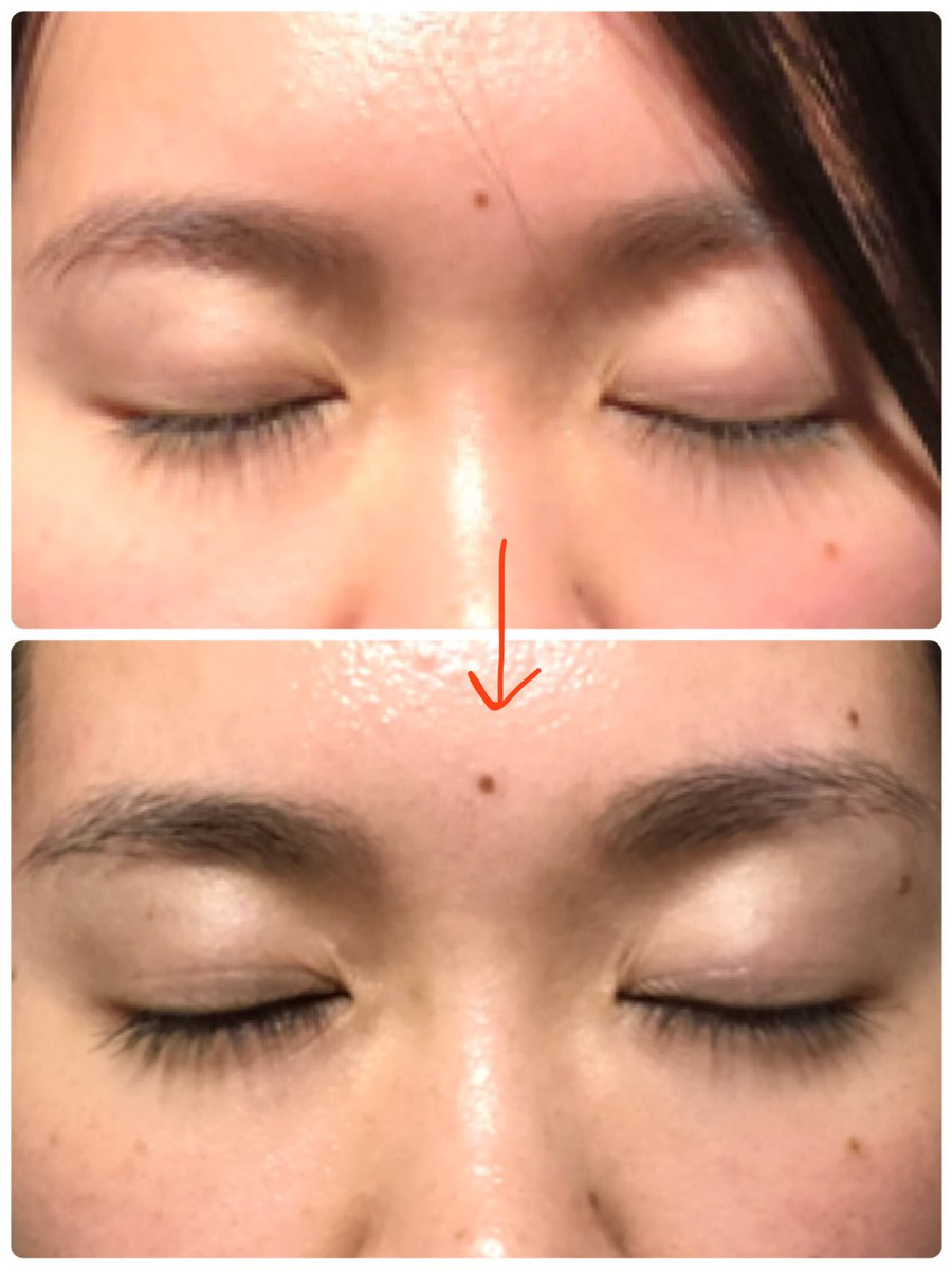 Haruka 瑶香 ファスティング2日目の朝 なんかもうすでに効果が いつもの二重幅がくっきり線ついてむくみのない目元になってるぅ ビフォーは去年の12月ね あ おはようございます O