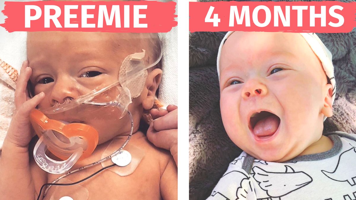 LexusLynn's tweet photo. Come watch as this Preemie Baby Grows Up https://t.co/MTIGgoMVwZ https://t.co/GDw7ZT9v5S