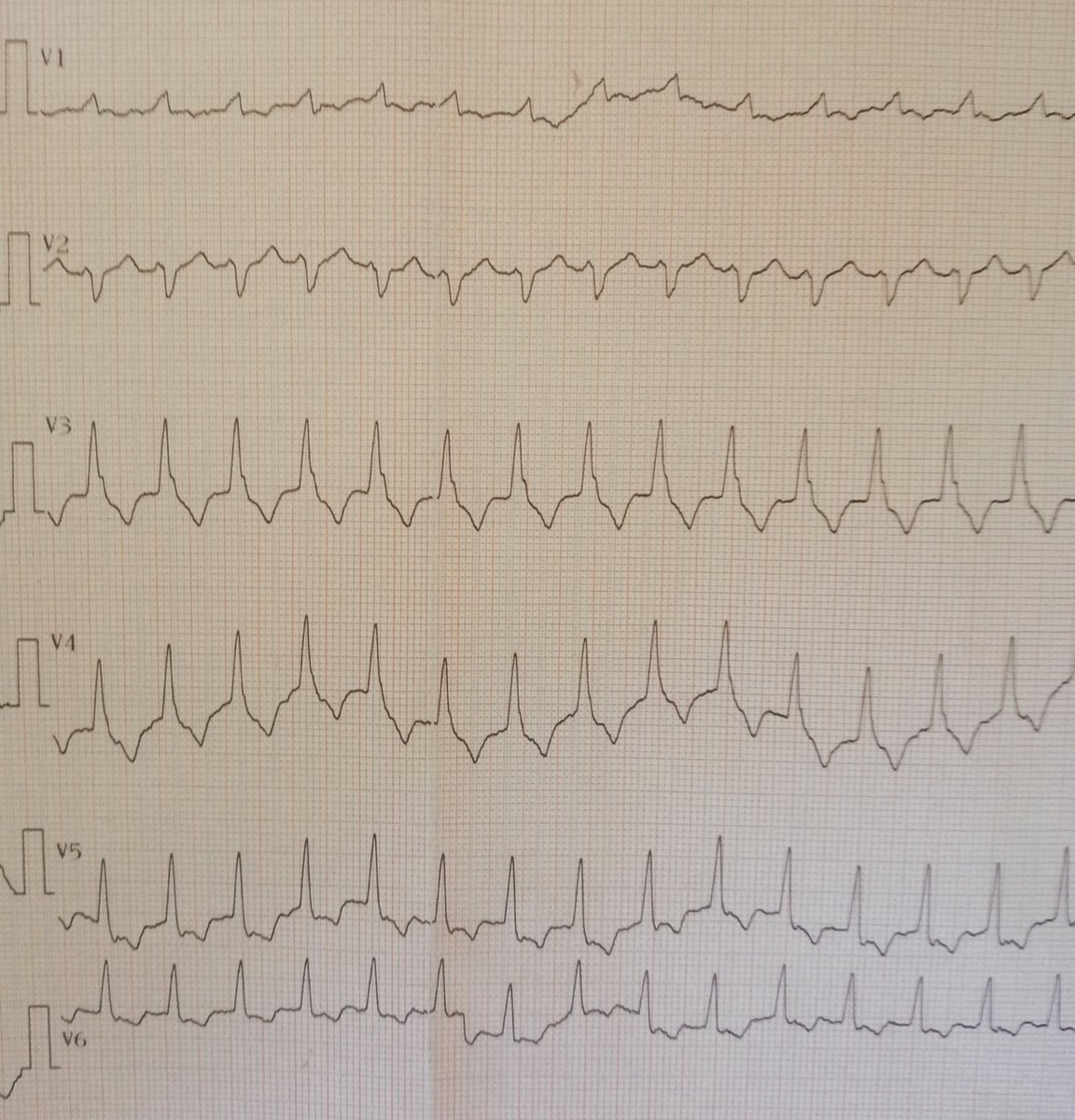 Bencharif Nazim tweet media