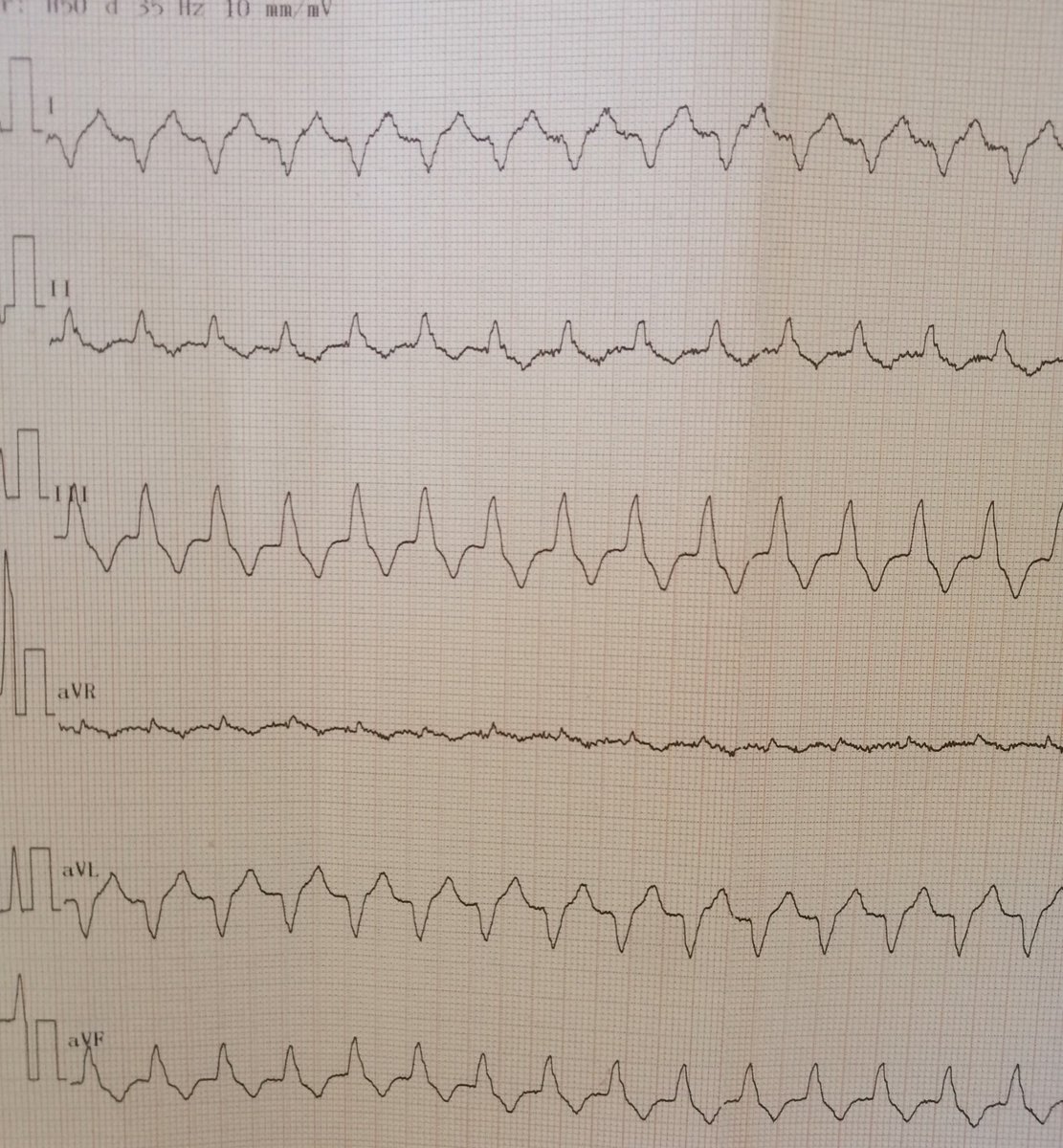 Bencharif Nazim tweet media