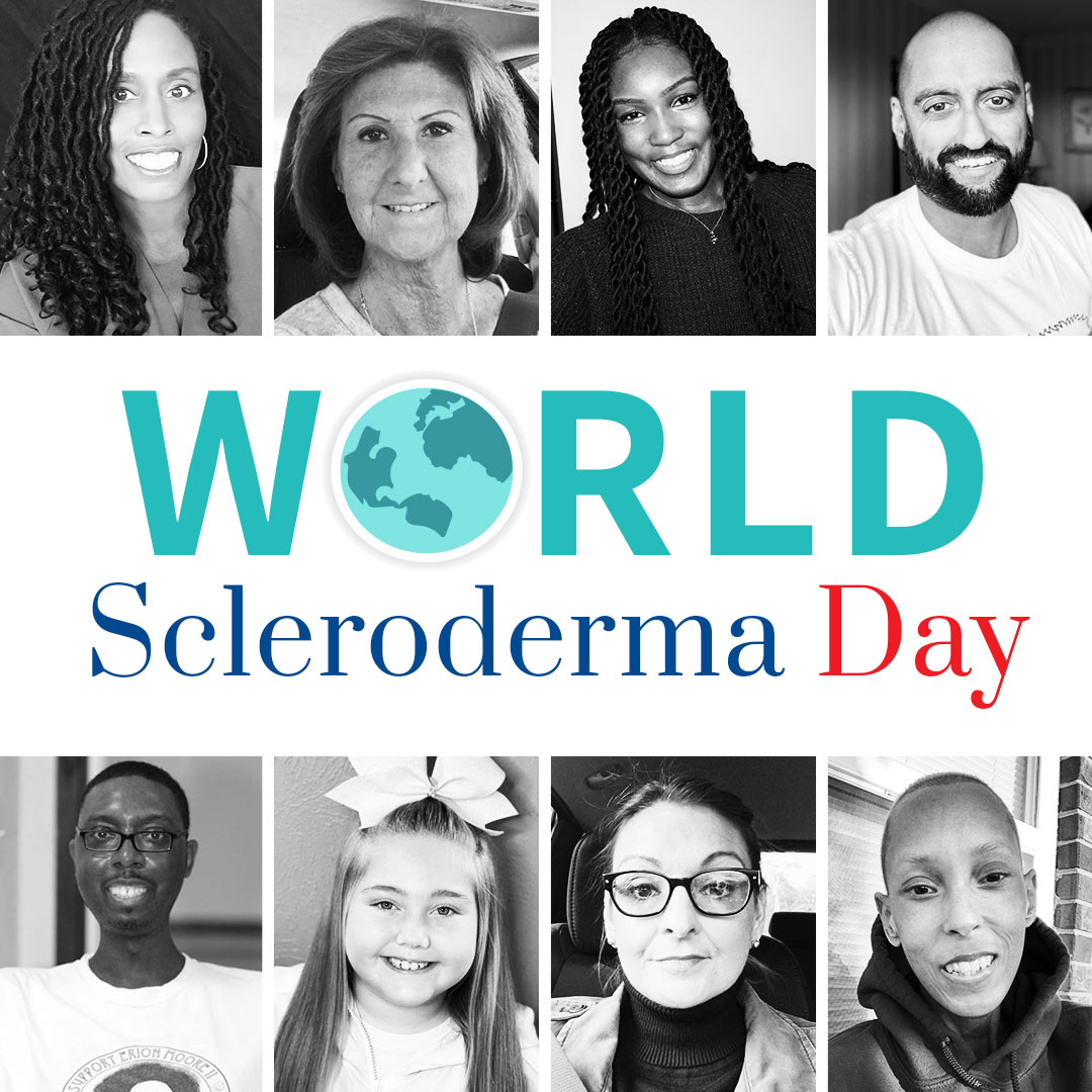 SclerodermaCAN's tweet image. Today is World Scleroderma Day – a day dedicated to getting loud and raising awareness. Speak up and spread the word about the faces of scleroderma. #SclerodermaAware bit.ly/3biNBQh