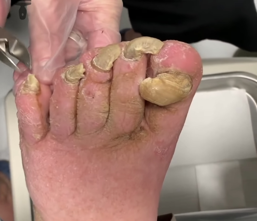 Coming out of lockdown ready for a pedicure