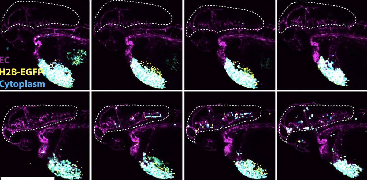 MIT Biology (@mitbiology) on Twitter photo A new <a href="/CR_AACR/">Cancer Research</a> study featuring Richard Hynes <a href="/kochinstitute/">Koch Institute at MIT</a> and Scott Manalis <a href="/MITdeptofBE/">MIT Dept of BE</a> shows that the YAP oncogene can affect the distribution of tumor cells within an animal — influencing the global pattern of metastasis: bit.ly/2VsM8lB A new <a href="/CR_AACR/">Cancer Research</a> study featuring Richard Hynes <a href="/kochinstitute/">Koch Institute at MIT</a> and Scott Manalis <a href="/MITdeptofBE/">MIT Dept of BE</a> shows that the YAP oncogene can affect the distribution of tumor cells within an animal — influencing the global pattern of metastasis: bit.ly/2VsM8lB
