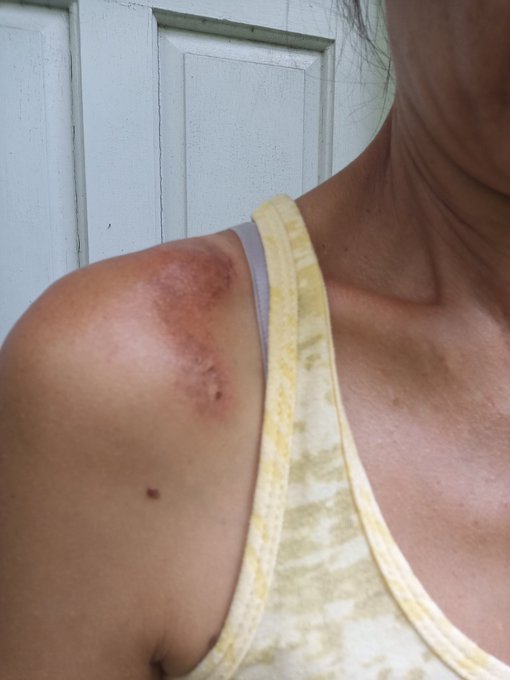 A few candid  pics of me.. https://t.co/iJLBtq8CvZ