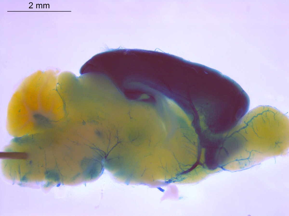 GeneOfTheDay's tweet photo. Today’s #GeneOfTheDay is #Junb. Human diseases associated with this gene include holoprosencephaly. Mice with this gene inactivated exhibit abnormal forebrain, midbrain and hindbrain development. More data here: https://t.co/IltCEGUjTp https://t.co/XArA2igyZt
