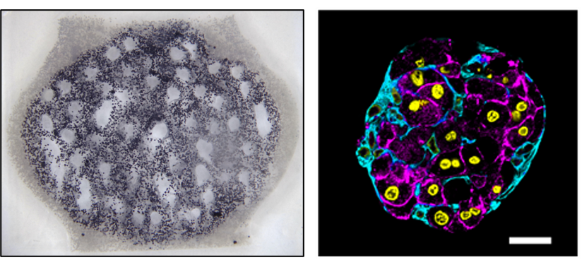 ian_kins_'s tweet photo. And finally, we worked with @kellystevenslab to study primary hepatic aggregates in perfused gels. 3D dendritic networks can support these delicate cell aggregates by getting them the oxygen + nutrients they need. 6/ https://t.co/lXqhSOxptt
