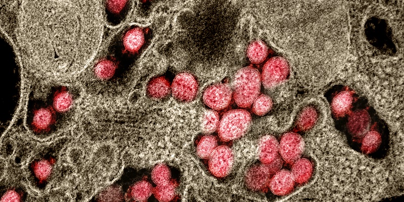 2minmed's tweet image. Prone positioning in non-intubated COVID-19 patients with acute respiratory failure may transiently improve blood oxygenation levels dlvr.it/RZbkLc #ChronicDisease #Emergency