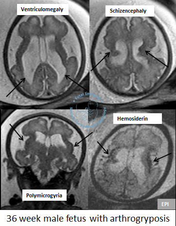 Fetal Imaging tweet media