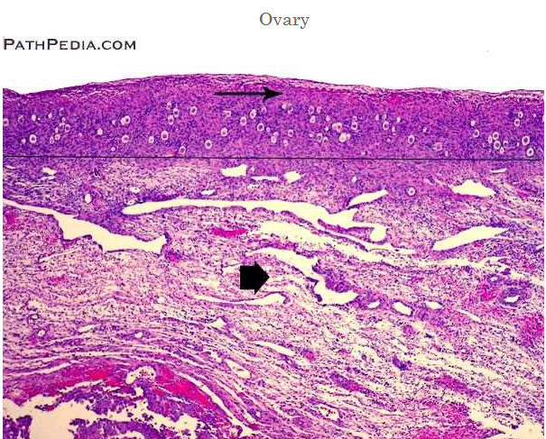 Normal histology - ovary.