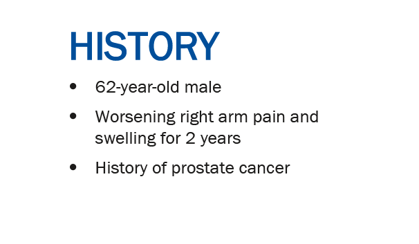 SSRbone's tweet photo. Happy Monday, musculoskeletal community! 

The SSR 2020 Virtual Meeting Case of the Day (COD) #5 is now live! 

Have a look below for a sneak peak (members &amp; non-members!)

Answer &amp; explanation will be posted here tomorrow: https://t.co/m6WDWtF3qY

#MSKRad #SSR2020 https://t.co/N39780HO4k