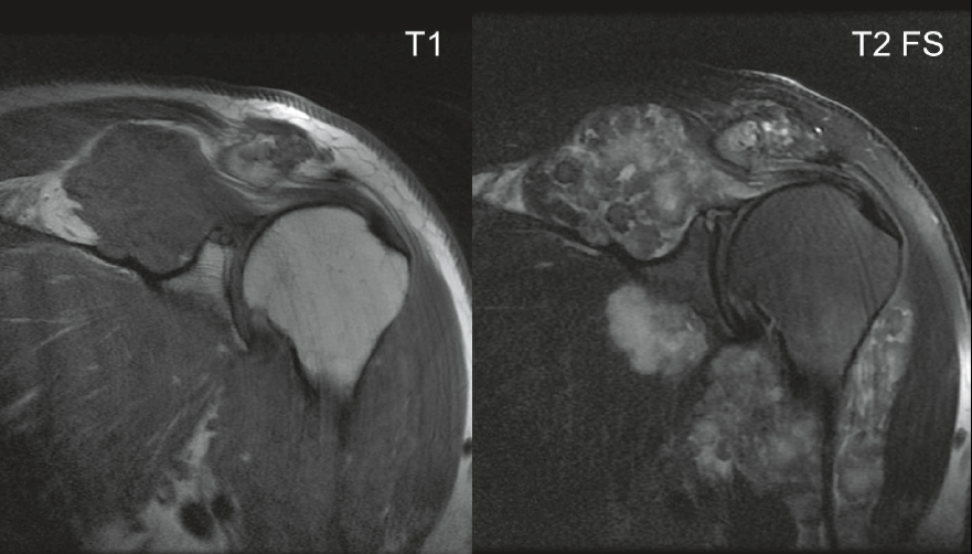 SSRbone's tweet photo. Happy Monday, musculoskeletal community! 

The SSR 2020 Virtual Meeting Case of the Day (COD) #5 is now live! 

Have a look below for a sneak peak (members &amp; non-members!)

Answer &amp; explanation will be posted here tomorrow: https://t.co/m6WDWtF3qY

#MSKRad #SSR2020 https://t.co/N39780HO4k
