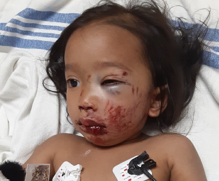 CalgaryPolice's tweet photo. Kaylie remains in hospital with serious injuries #yyc https://t.co/uhlxGx003d