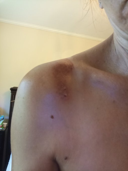 Next time I wear no tank top. LoL I learned many things not to do next time and who not to take.. bob