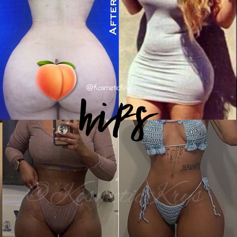 Examples of “Hips” in all different sizes