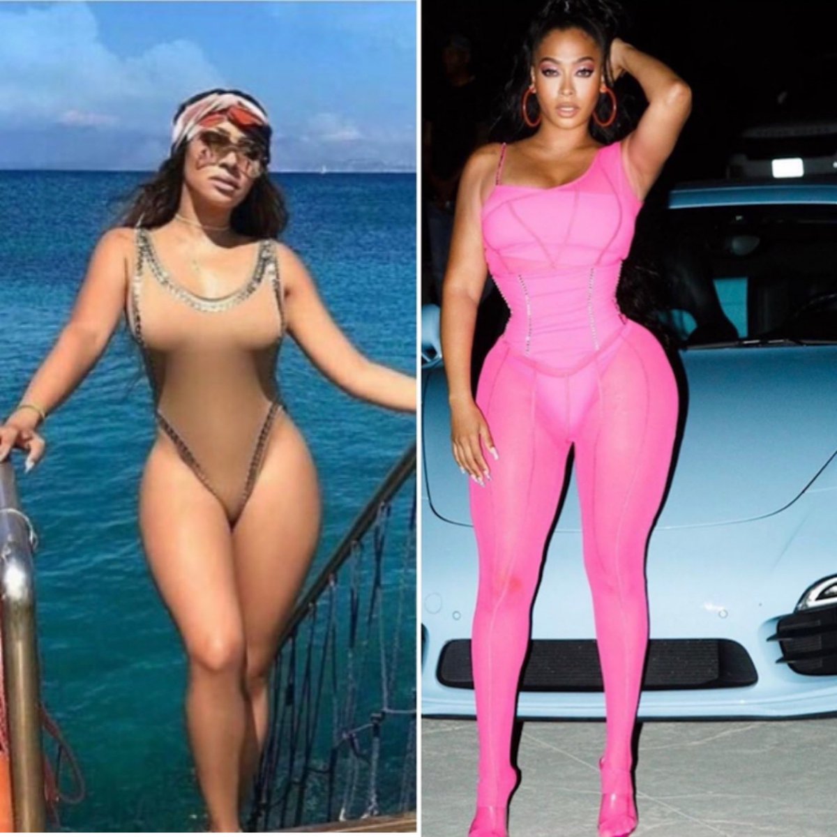 Classic celebrity example . Our girl LaLa. Sis been getting surgery for like 10 years. It took multiple rounds to correct her inverted V shape.