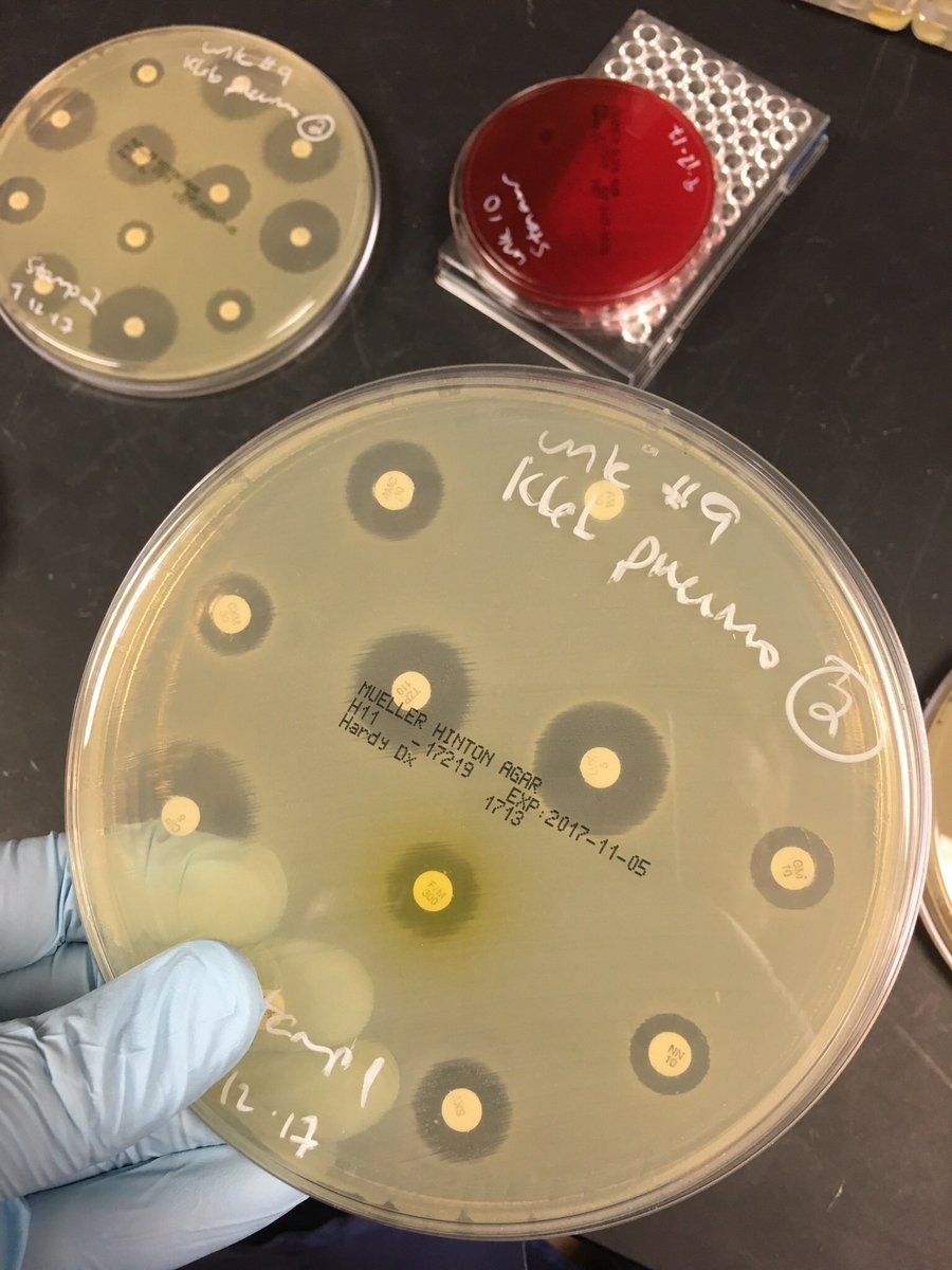 Oh, "why are they different sizes?"The smaller plates are the standard plates we use for culturing/isolating bacteria colonies. The larger plates are used for disk diffusion antibiotic testing.This large one was near its expiration date. This seemed like a good use for it…