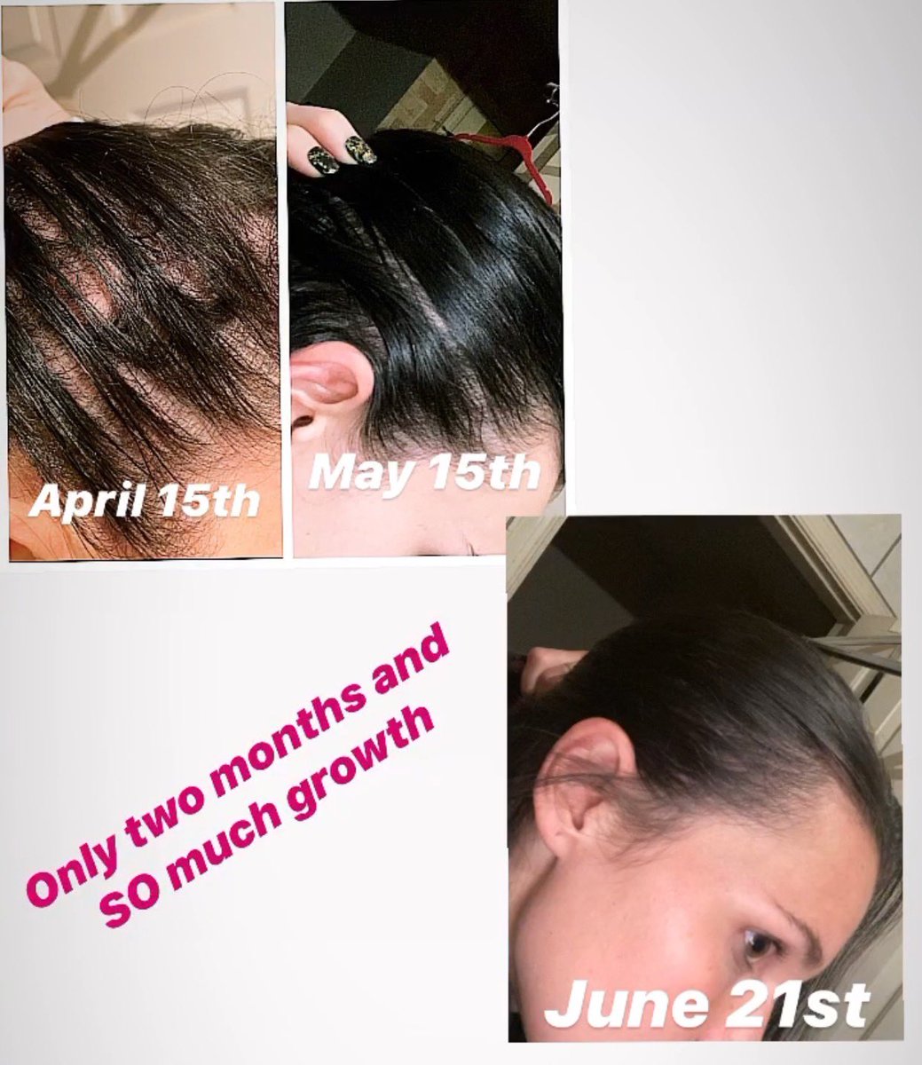 Vegamour Review Does Vegamour Hair Grow Work​