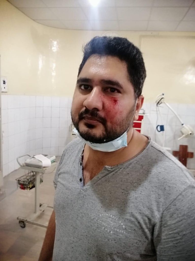 VoiceOfDoctors's tweet photo. Another day another incident of violence, Dr Muzamil (CHC Multan) was beaten badly by attendants of a patient. Govt is probably waiting for a major incident to happen, for security legislation.
#Security4Doctors https://t.co/QSVPme30gT