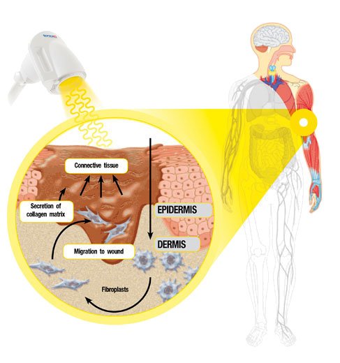 Beautywhitton's tweet photo. Heal your #wounds, #skinproblems, and #pain with bioptron #lighttherapy!
#Bioptron has a positive & long-lasting effect not only on the #treatedarea but also on the #wholebody. Make an appointment for this fast, easy, and effective treatment with our experts! https://t.co/DjtPnduJ2a