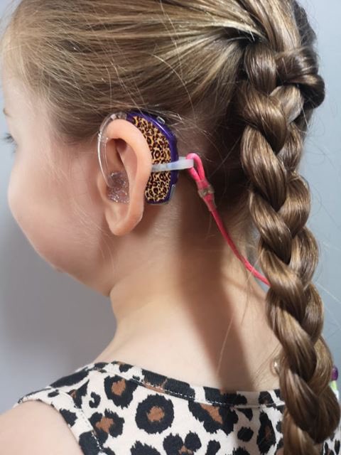 YPS_Digital's tweet photo. Our customer, HEAROES, prints custom hearing aid skins for children with a Mimaki CJV150-75. https://t.co/96tRljVF0k #mimaki #mimakicjv #hearingloss #custom #hearingaidskin #Children #cochlearimplant #advancedbionics #customhearingaid #BAHA #Kanso #customskin #deviceskin https://t.co/NKLbVHOJp9