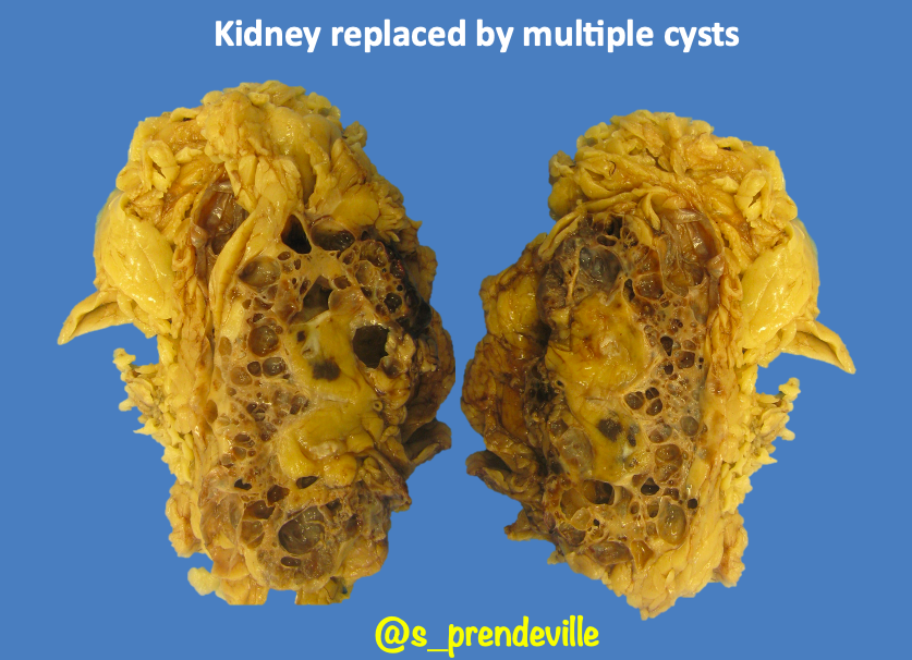 Susan Prendeville tweet media