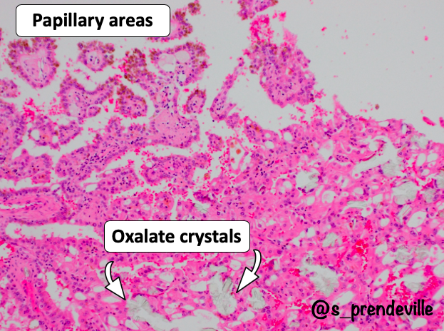 Susan Prendeville tweet media