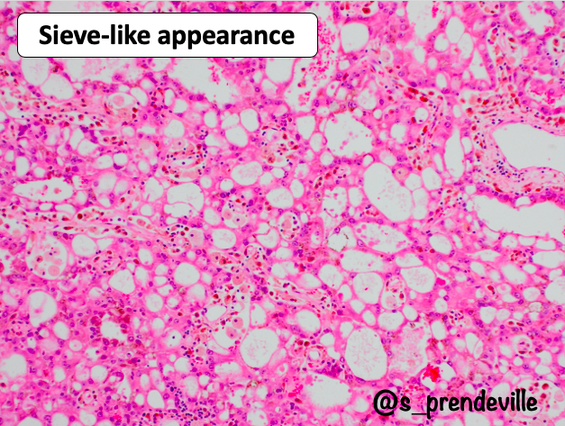 Susan Prendeville tweet media