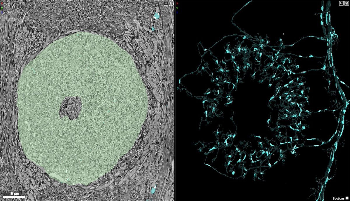 Stephen Plaza (@stephenplaza) on Twitter photo Join <a href="/janeliaflyem/">Janelia Fly EM</a> for a live #hemibrain public discussion on zoom today in a couple hours 11AM-1PM EST (hhmi.zoom.us/j/94083683709). Lots of interesting topics (geared toward data users) plus a preview of some new results! Join <a href="/janeliaflyem/">Janelia Fly EM</a> for a live #hemibrain public discussion on zoom today in a couple hours 11AM-1PM EST (hhmi.zoom.us/j/94083683709). Lots of interesting topics (geared toward data users) plus a preview of some new results!