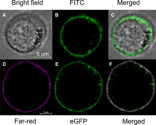 FEBS_Letters's tweet photo. #Shigatoxin B-subunit (STxB)-mediated cargo delivery into #cancer cells: a real-time cell-binding assay reveals details of the interaction between STxB and its receptor Gb3 and their cointernalization→https://t.co/mmRiSHEChL #cancertherapy #targetedcancertherapy #endocytosis https://t.co/txNy4p4CuP