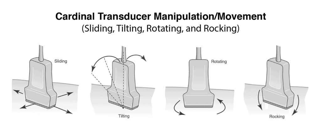 (3) Handling the ultrasound probe and proper movement is essential to obtaining optimal ultrasound images. Learn the Essential Movements:•Sliding•Tilting•Rotating•Rocking•Compression https://pocus101.com/knobology 