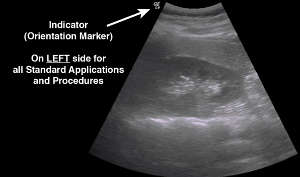 (9) Understand how the Indicator (orientation marker) on the probe correlates with the ultrasound image.Standard: Left side of the screenCardiac: Right side of the screen https://pocus101.com/knobology 