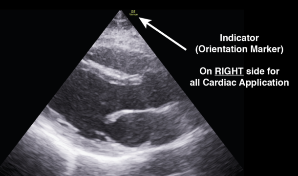 (9) Understand how the Indicator (orientation marker) on the probe correlates with the ultrasound image.Standard: Left side of the screenCardiac: Right side of the screen https://pocus101.com/knobology 