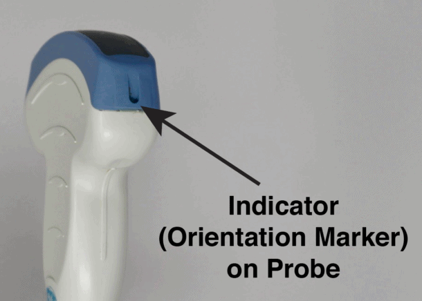 (9) Understand how the Indicator (orientation marker) on the probe correlates with the ultrasound image.Standard: Left side of the screenCardiac: Right side of the screen https://pocus101.com/knobology 