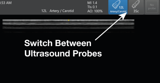 (13) Step 2: Select the correct Probe/Transducer. Picking the wrong transducer for an application is a fatal flaw! https://pocus101.com/knobology 