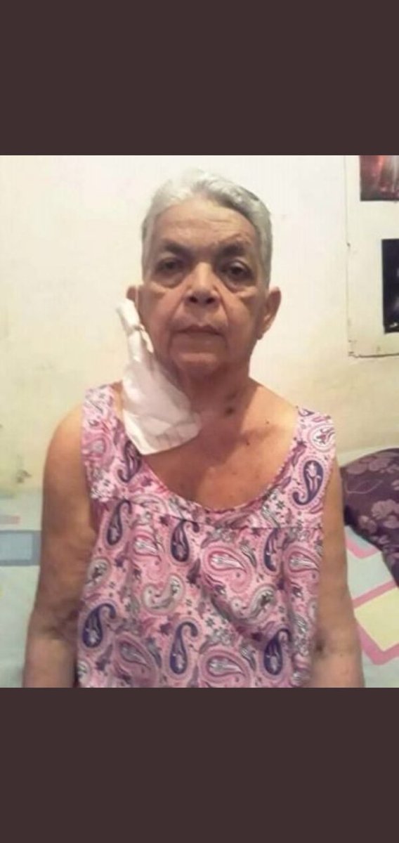 ReporteYa's tweet photo. #30Jun #ServicioPublico #Maracaibo Se necesita con urgencia una unidad de diálisis en Maracaibo para la paciente, Alba Martínez, de 70 años de edad, quien lleva dos semanas sin hacerse las diálisis.

 Ana González 0414-6228308. https://t.co/eMbHpzAzpK