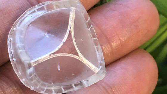 DrMoritzWvB's tweet photo. What if you only needed one #AVR in your lifetime, without the need for #OAC? This could be a game changer, and we are getting closer to having a solution (this is the 2nd #valve of its kind in 12 months)!
#lifelongcare #SAVR #cardiotwitter @ctsnetorg
https://t.co/mgRVVyeqyM https://t.co/lFCY5SJEiH