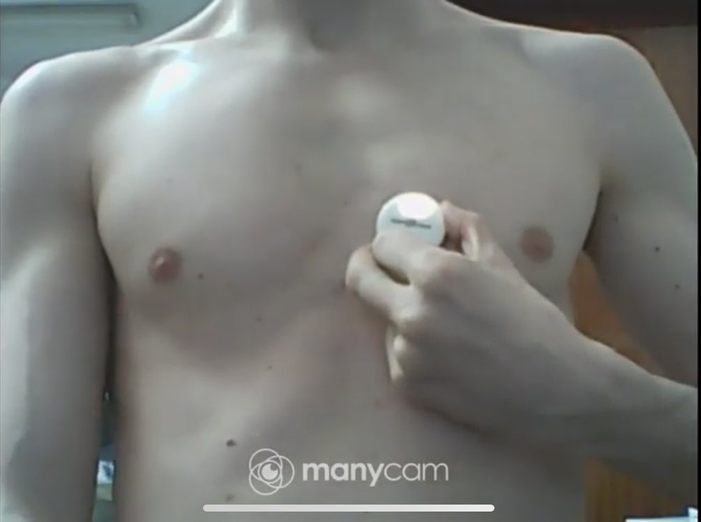 ItalianBoyHB's tweet photo. My 1st hb recording using Stemoscope https://t.co/ZacxxzL2uB via @YouTube #heartbeat #auscultation #cardiophile #stethoscope https://t.co/HaXHZJPEY7