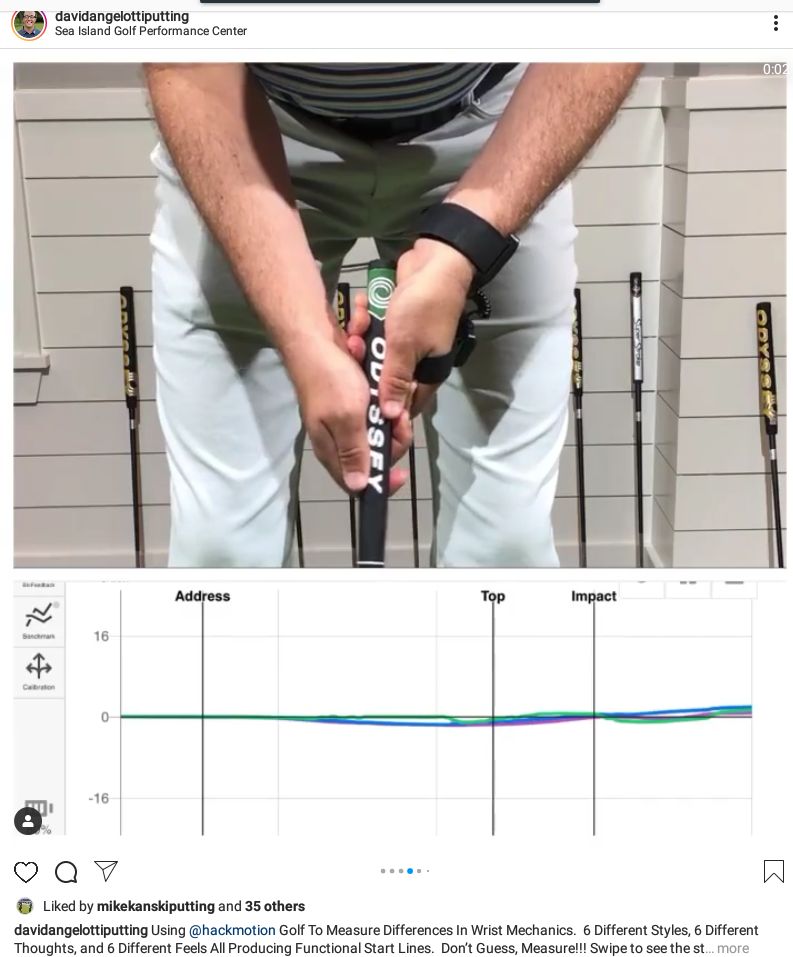 DynAlignGolf's tweet image. While a grip with thumbs down the top can produce a functional start line, this #hackmotion graph shows impressive stability throughout the stroke with both hands outwardly rotated. This type of grip, with variations, has been used by some of golf&apos;s great putters. #putting #golf