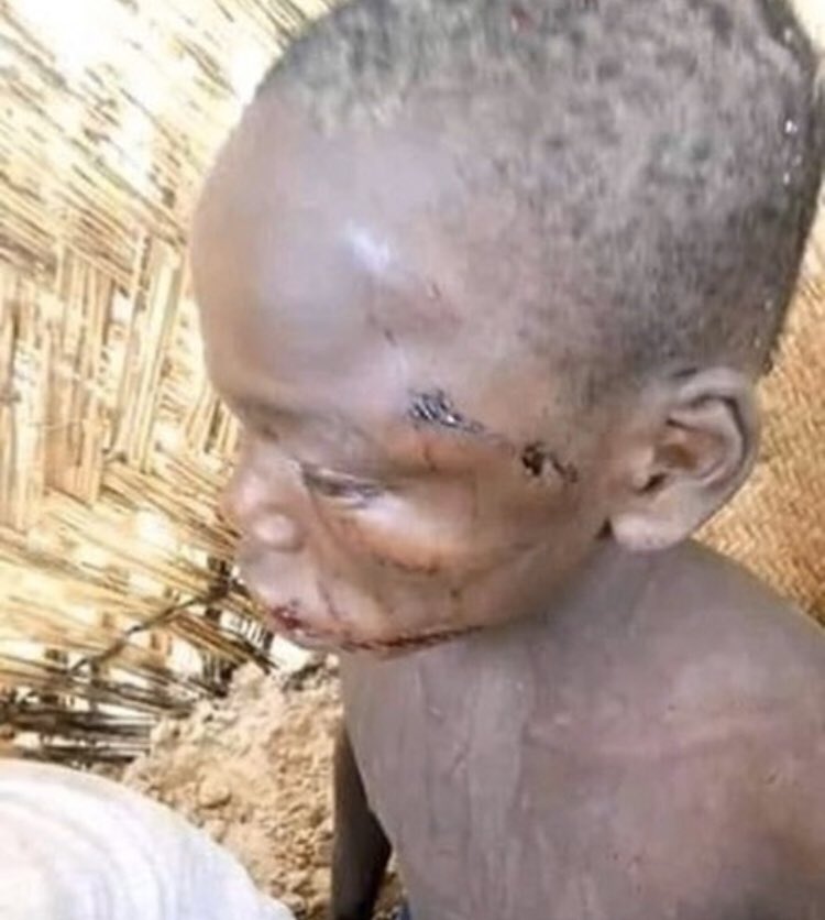 6yetlig's tweet photo. En gros depuis que le Soudan et le Soudan du Sud se sont séparés c’est la guerre
Et bref les femmes et les enfants sont les plus atteints et les enfants sont vrm maltraités 
Même moi je viens de l’apprendre jsuis littéralement choquée prsn en parle https://t.co/67jm5ecAhV