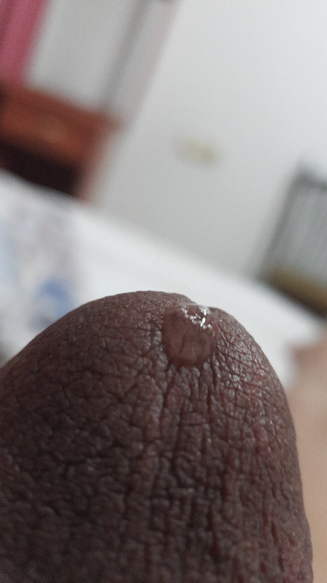 Hep arka olmaz ama demi ya😂 kimler tadına bakmak ister 🤔🤩🥰📌