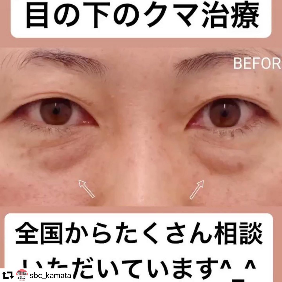 湘南美容外科クリニック 蒲田院 Sbc Kamata Twitter 湘南美容外科クリニック 蒲田院 Sbc Kamata Twitter