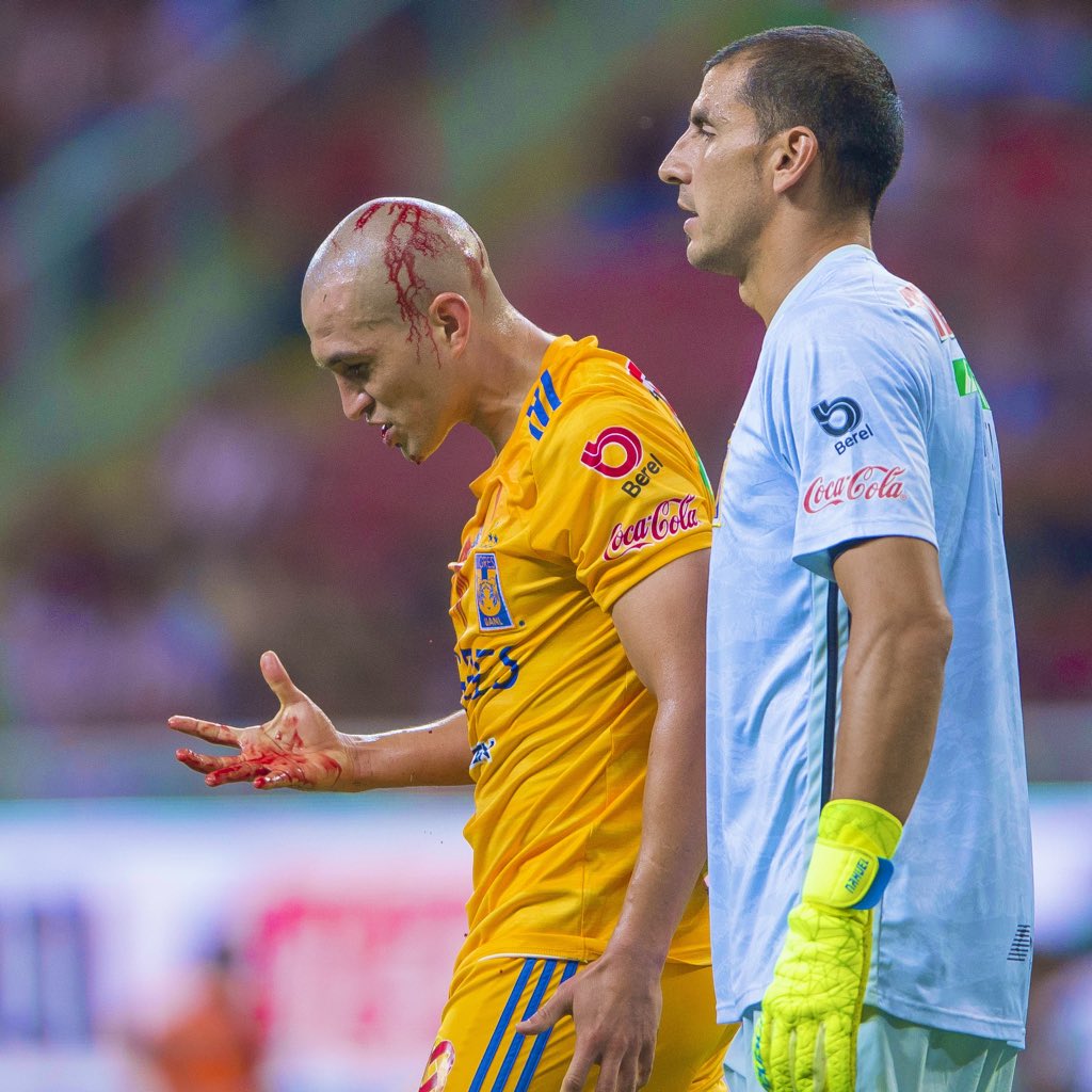TigresOficial's tweet photo. 🔝 El perfecto reflejo del amor por una camiseta y del perfil Tigre... 🐅

¿Cómo no querer a @JTorresNilo?

#EstoEsTigres 🐯
#6DecadasDeTigres 🟡🔵 https://t.co/vUSlthxqyA