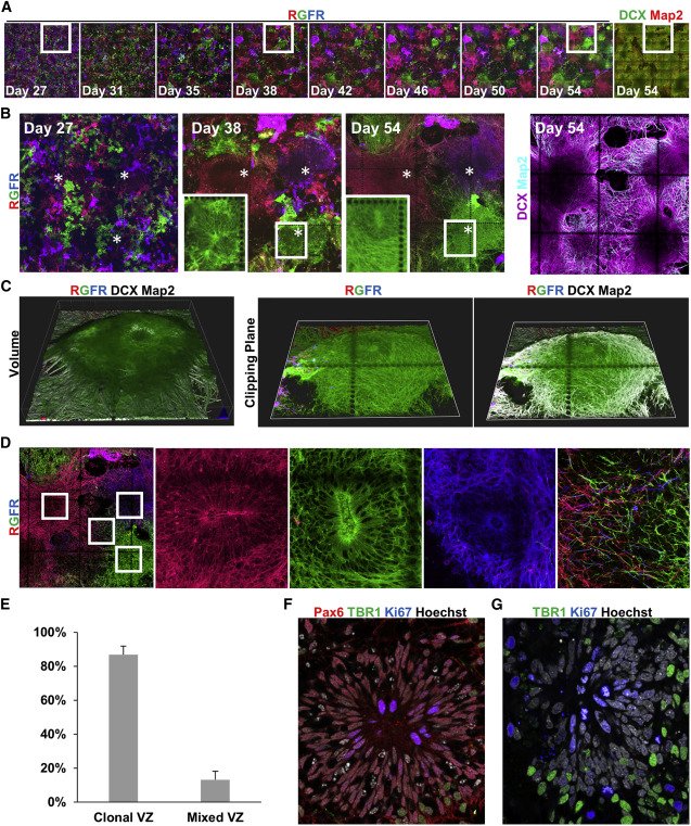 Danny El-Nachef (@delnachef) on Twitter photo cell.com/stem-cell-repo… Our work with rainbow barcoded human iPSC published in yesterday's <a href="/stemcellreports/">StemCellReports</a> issue. Hope this is a useful tool for the community. Thanks to the great team for making this work possible <a href="/UWISCRM/">ISCRM at UW</a>. Check out clonally dominant neuron progenitors below: cell.com/stem-cell-repo… Our work with rainbow barcoded human iPSC published in yesterday's <a href="/stemcellreports/">StemCellReports</a> issue. Hope this is a useful tool for the community. Thanks to the great team for making this work possible <a href="/UWISCRM/">ISCRM at UW</a>. Check out clonally dominant neuron progenitors below: