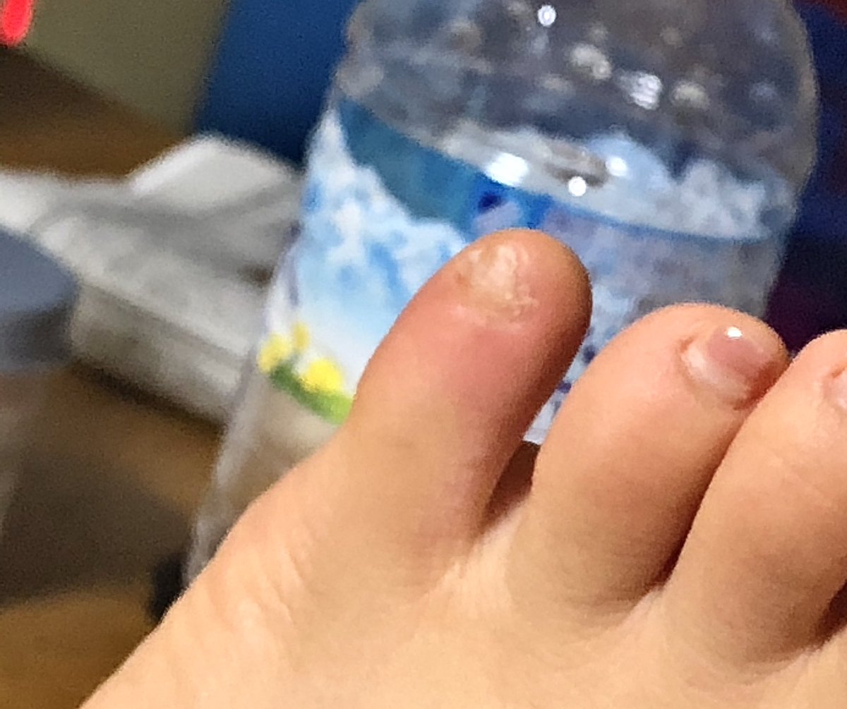 鷹媛はカムラの里観光中 A Twitter 足の形が四角いので三角の形が主のパンプスに合っていないから痛むのかもしれないですね スクエアトゥ パンプス で検索するとその足の形に合ったパンプスがいくつか出てきますよ 店員に訊きながらコーディネートするのもアリ 鷹媛はカムラの里観光中 A Twitter 足の形が四角いので三角の形が主のパンプスに合っていないから痛むのかもしれないですね スクエアトゥ パンプス で検索するとその足の形に合ったパンプスがいくつか出てきますよ 店員に訊きながらコーディネートするのもアリ