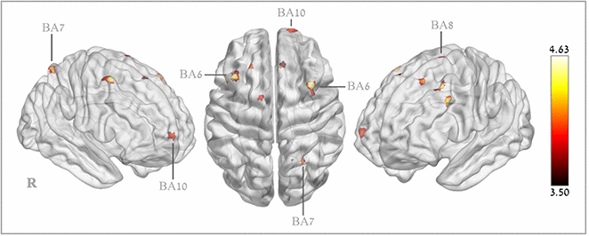 In an exciting new study, we found improvement in #cognitive abilities such as memory and attention in healthy older adults using #HBOT. Read more about this study from The Sagol Center for #Hyperbaric Medicine and Research in <a href="/AgingJrnl/">Aging-US</a>: bit.ly/2AFLvOl #aging