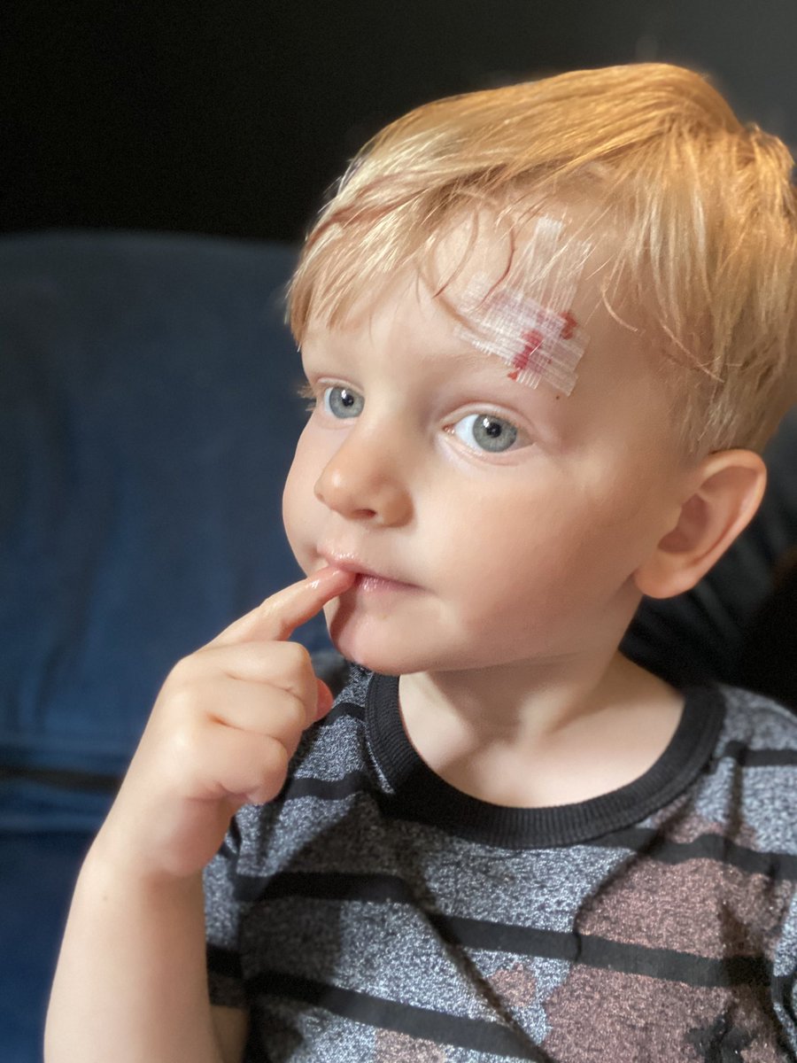 CarrieDuncanTEP's tweet photo. Be careful what you wish for kids. We’re just home from A&amp;E... #thankyouNHS https://t.co/pX7zTFJK6A
